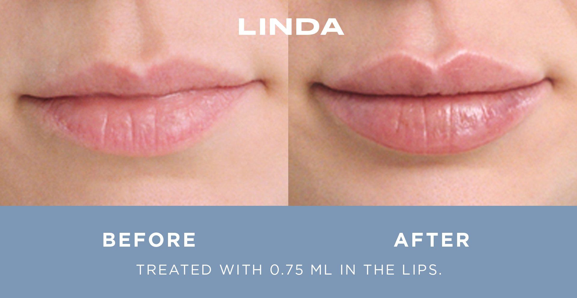 LINDA_BA-1920w